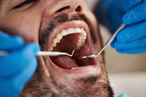 Best Emergency Pediatric Dental Care in Suitland, MD